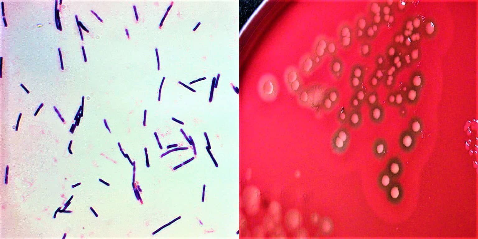 Fødevareforgiftning: Clostridium perfringens Fødevareforgiftning: Clostridium perfringens