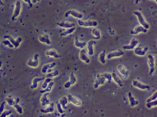 Naegleria fowleri infektion (hjerne-spiser amøbe)