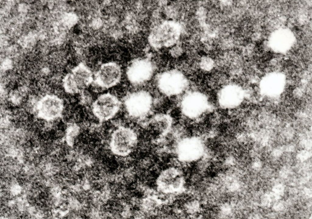 Parvovirus i blod.jpg