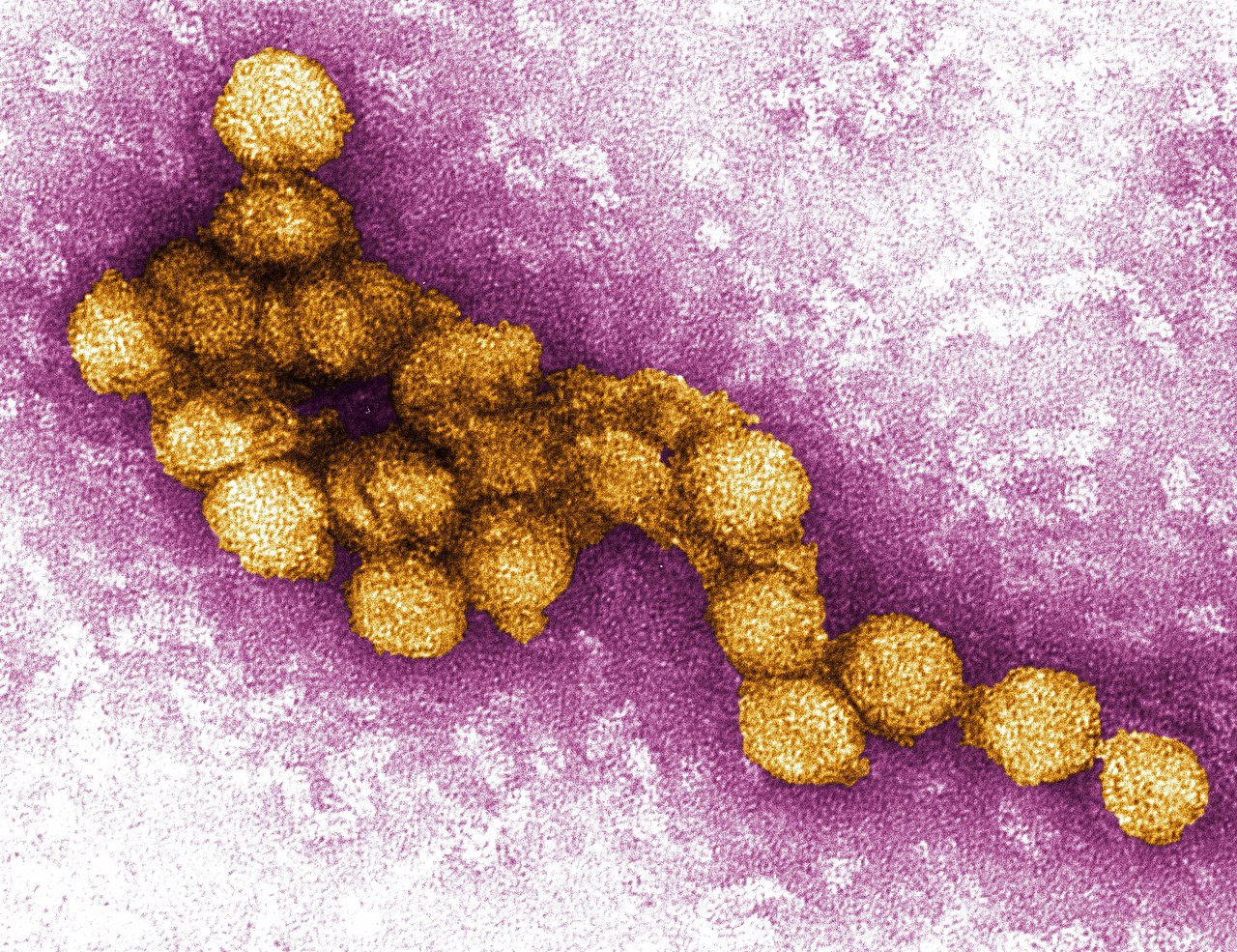 West Nile-virus: symptomer og behandling