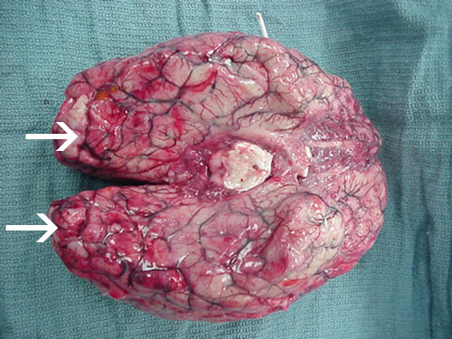 Omfattende blødning og nekrose er til stede i hjernen, hovedsageligt i frontal cortex.