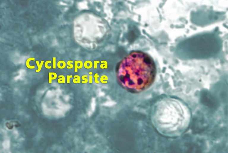 Cyclospora infektion: symptomer, årsager og behandling