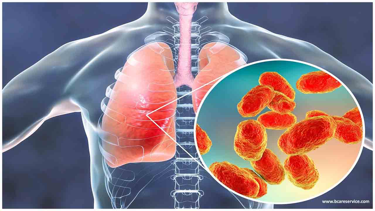 Bakteriel lungebetændelse: symptomer og behandling