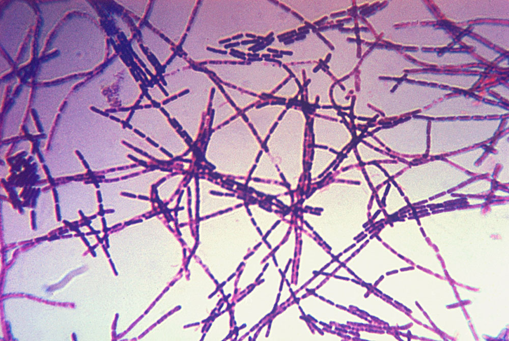 Bacillus anthracis-bakterie