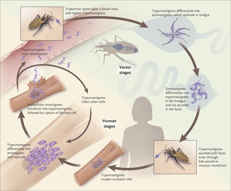 https://meddk.com/wp-content/uploads/2021/01/nejmra1410150_f1.jpeg